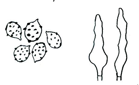 Leucopaxillus alboalutaceus (F.H. Mller & Jul. Schff.) Ml